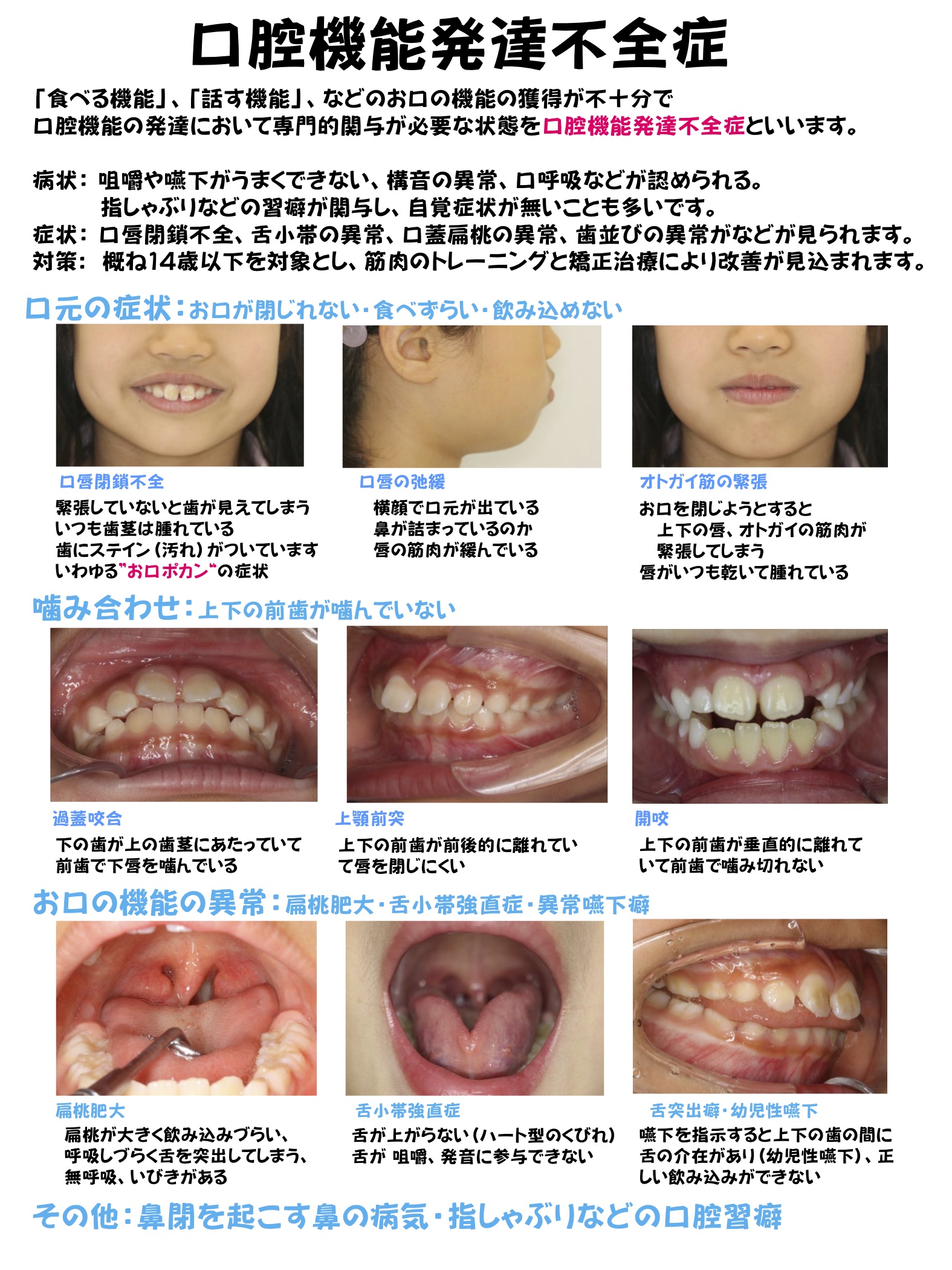 診療内容 ひとみ矯正歯科クリニック